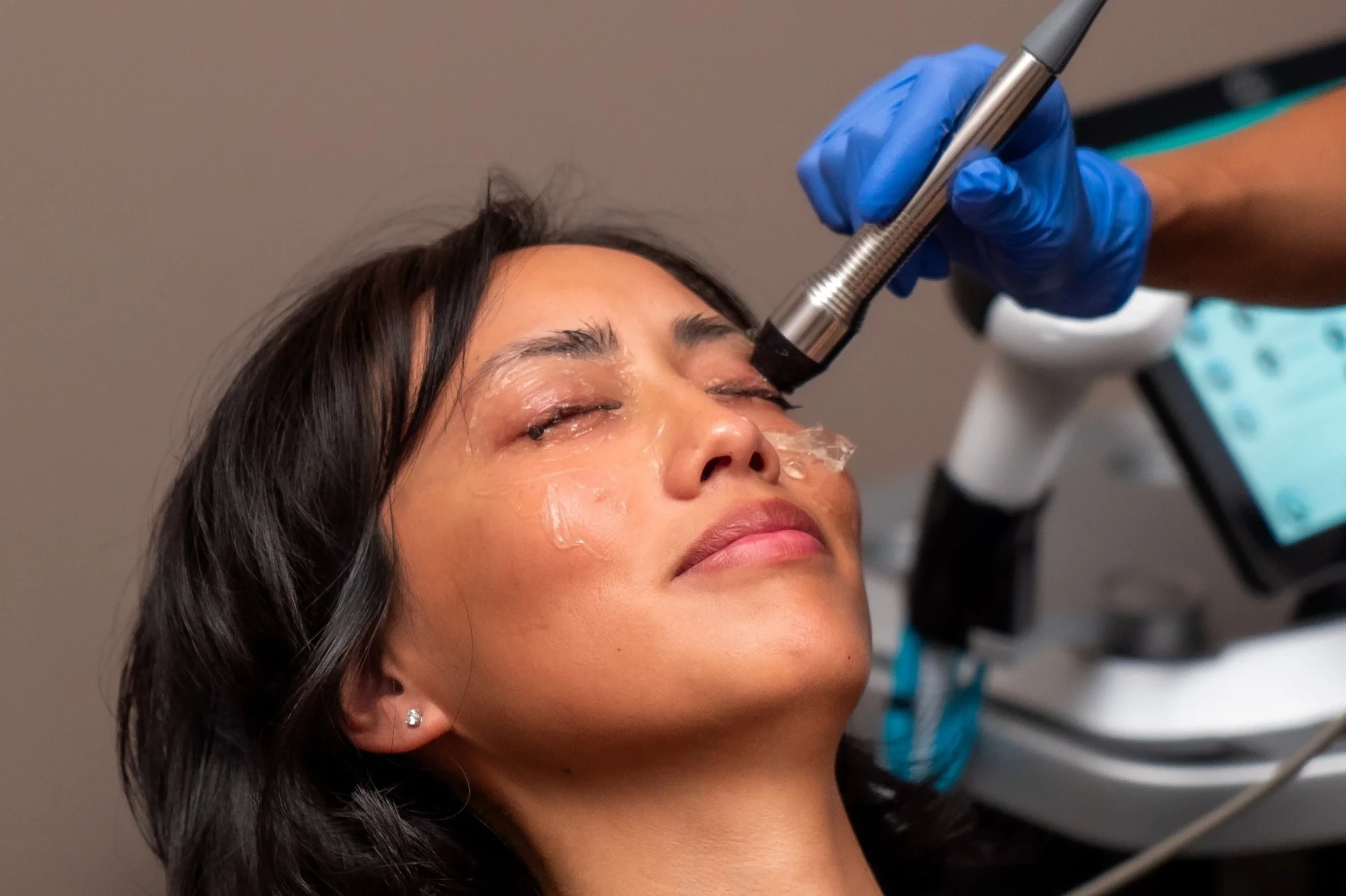 Forma Eye Advanced Dry Eye Treatment | InMode Technology | Lasting Relief